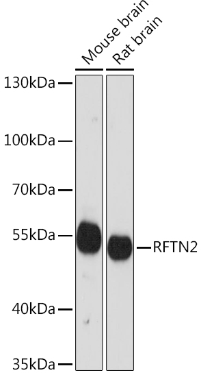 Anti-RFTN2 Antibody (CAB14445)