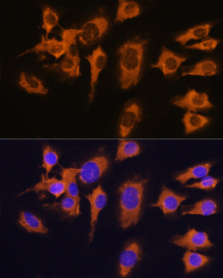 Anti-SLC20A1 Antibody (CAB4117)
