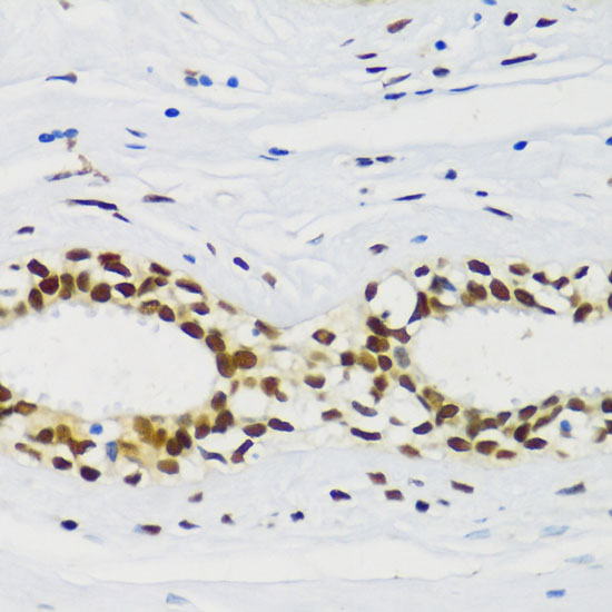 Anti-CIRBP Antibody (CAB6080)