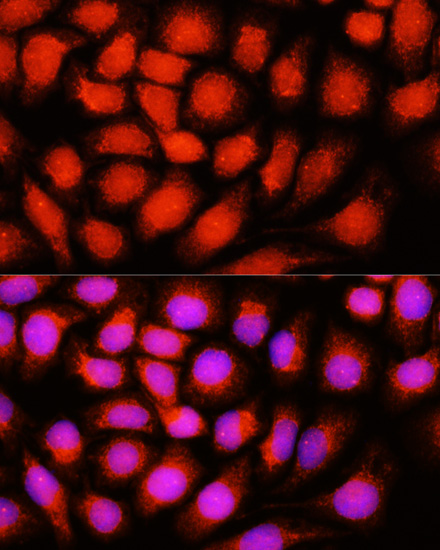 Anti-ACADVL Antibody (CAB7865)