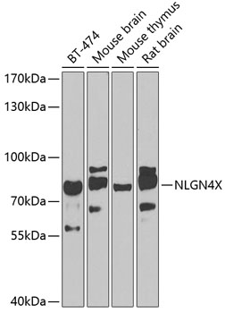 Anti-NLGN4X Polyclonal Antibody (CAB7986)