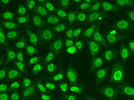 Anti-Chk2 Antibody (CAB0466)