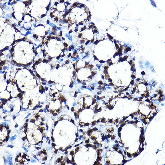 Anti-PPAR gamma Antibody (CAB11183)