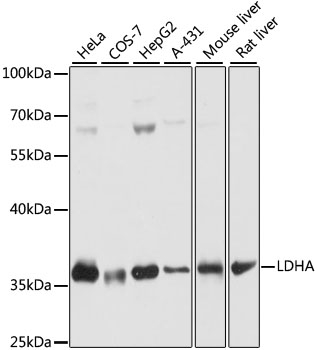 Anti-LDHA Antibody (CAB16394)