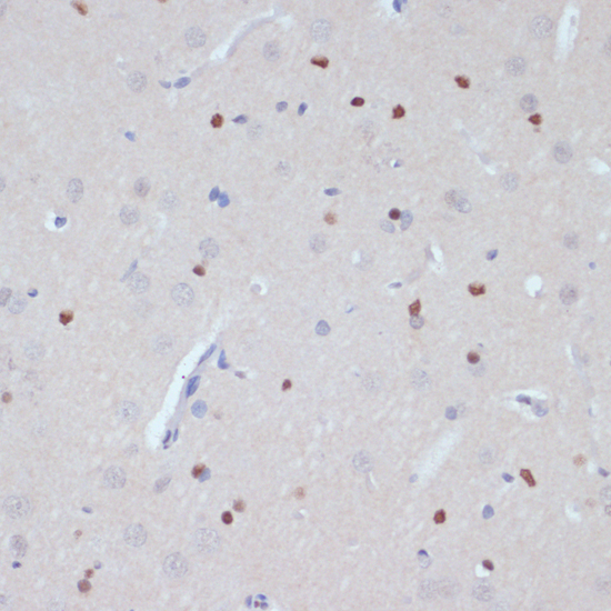 Anti-ESRRA Antibody (CAB14184)