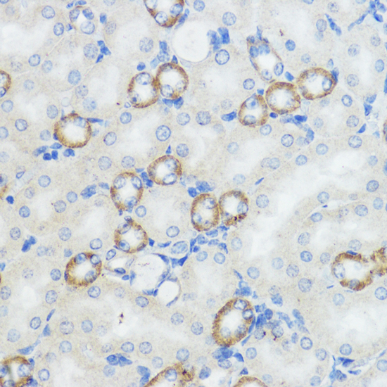 Anti-NOD1 Antibody (CAB1246)