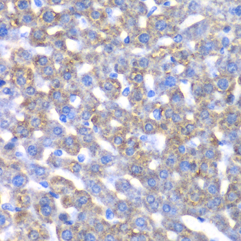 Anti-CCBL1 Antibody (CAB6542)