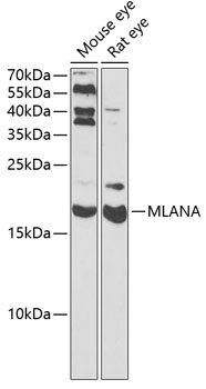 Anti-MLANA Antibody (CAB6290)