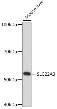 Anti-SLC22A3 Antibody (CAB18588)