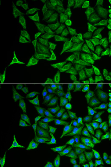 Anti-KRT20 Antibody (CAB0248)