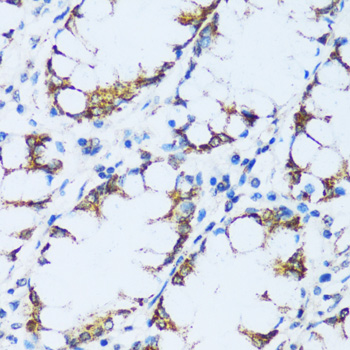 Anti-C1QC Polyclonal Antibody (CAB9227)