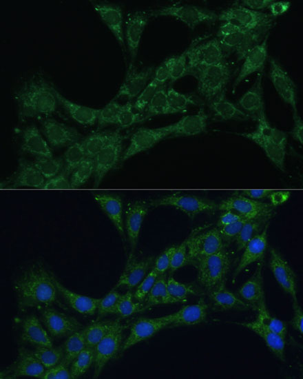 Anti-ETFB Antibody (CAB16043)