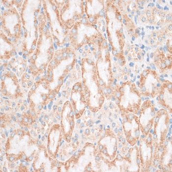 Anti-HMGA1 Antibody (CAB12693)