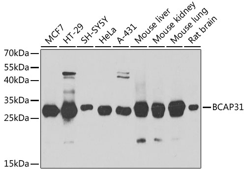 Anti-BCAP31 Antibody (CAB7056)