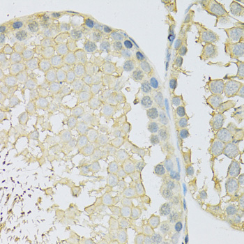 Anti-SLC2A9 Antibody (CAB14606)