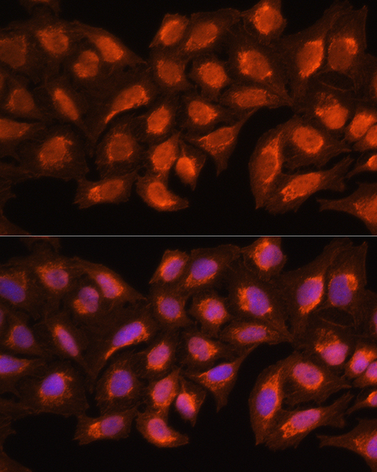 Anti-MRPL45 Antibody (CAB13197)