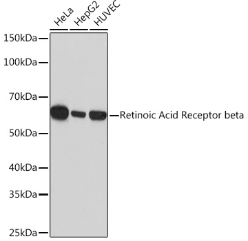 Anti-Retinoic Acid Receptor beta Antibody (CAB4535)