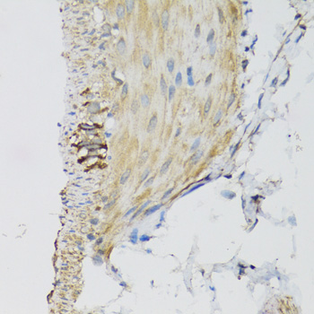 Anti-DGUOK Antibody (CAB6898)