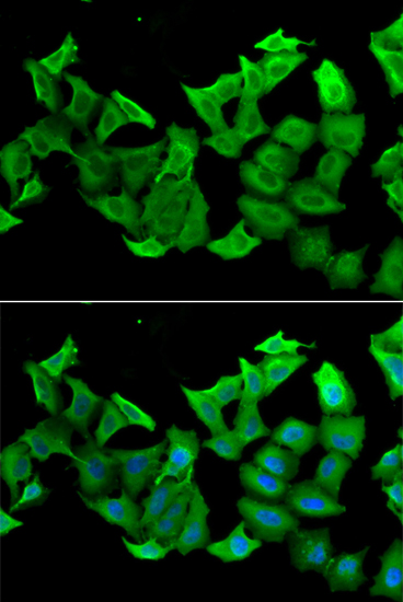 Anti-HAGH Antibody (CAB6615)