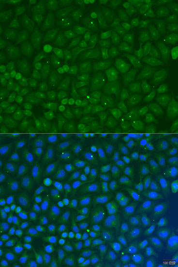 Anti-COG4 Antibody (CAB7792)