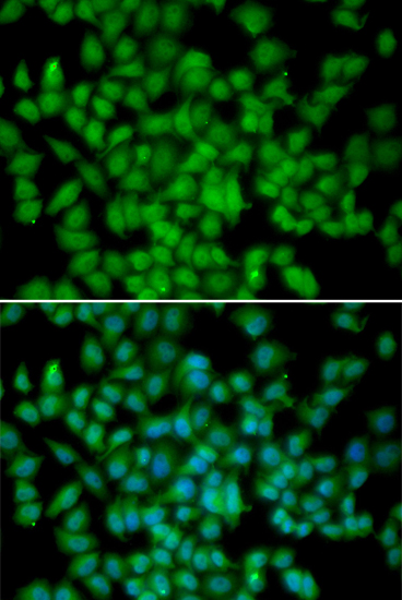 Anti-CDKN2C/p18-INK4C Antibody (CAB2042)