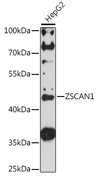 Anti-ZSCAN1 Antibody (CAB16639)