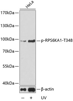 Anti-Phospho-P90RSK-T348 Antibody (CABP0166)