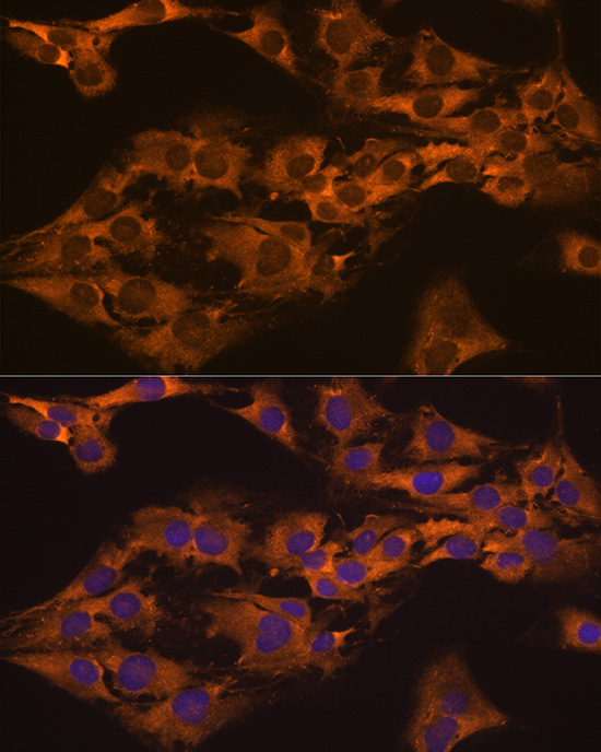 Anti-CAPRIN1 Antibody (CAB7910)