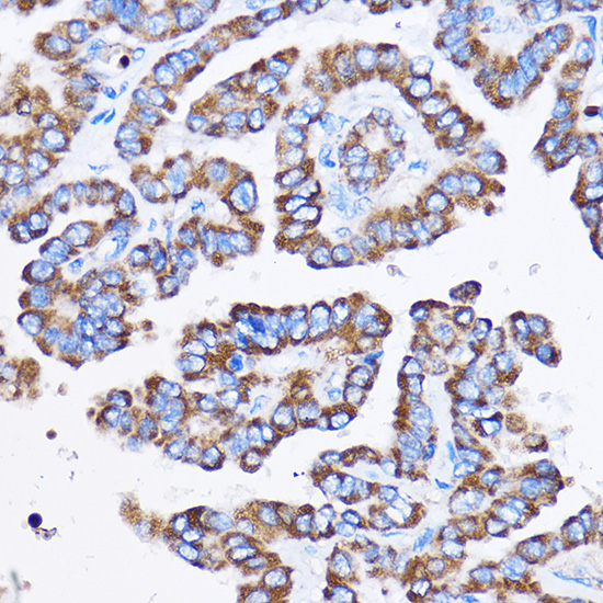 Anti-IL-23R Antibody (CAB1613)