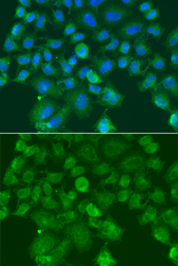 Anti-CST1 Antibody (CAB13290)