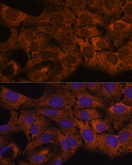 Anti-SEC23B Antibody (CAB15131)