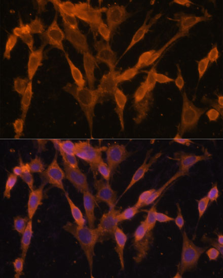 Anti-UBQLNL Antibody (CAB14451)