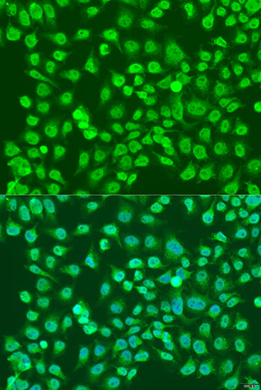 Anti-NPR3 Polyclonal Antibody (CAB8138)