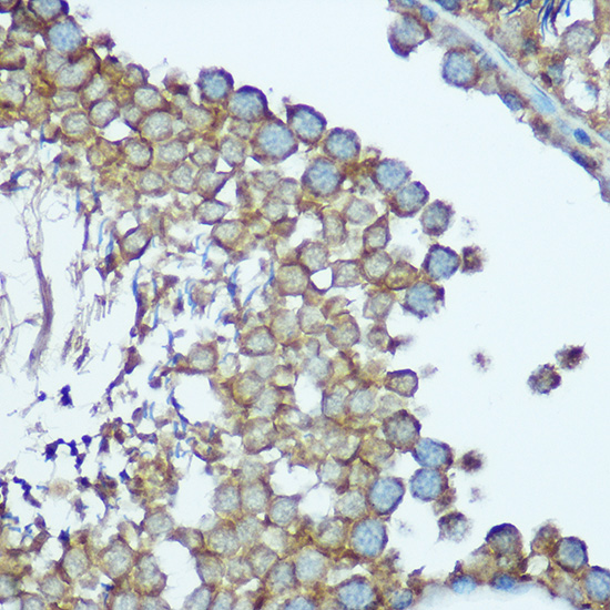 Anti-NDUFS1 Antibody (CAB2592)