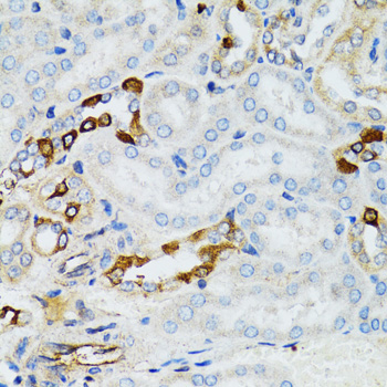 Anti-STAT3 Antibody (CAB5511)