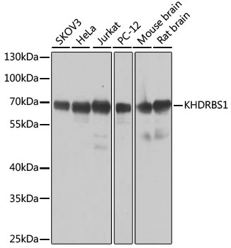 Anti-KHDRBS1 Antibody (CAB6101)