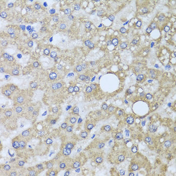 Anti-AARS2 Antibody (CAB7826)