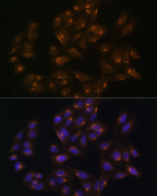 Anti-Sorting nexin-1 Polyclonal Antibody (CAB8625)