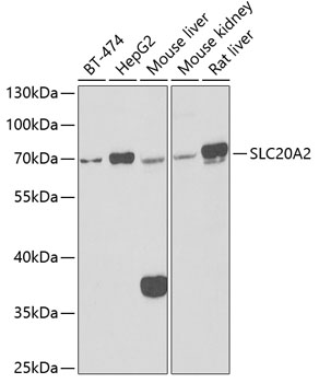 Anti-SLC20A2 Antibody (CAB6739)