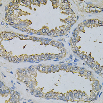 Anti-DBI Antibody (CAB13293)