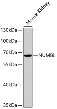 Anti-NUMBL Antibody (CAB2140)