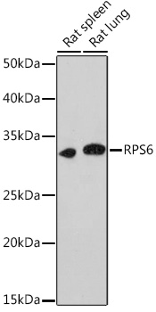 Anti-RPS6 Antibody (CAB6058)