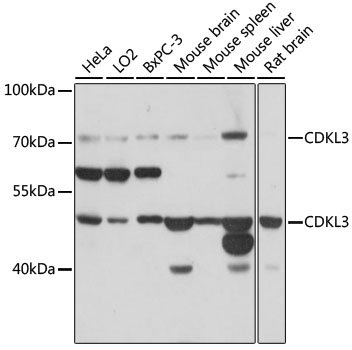 Anti-CDKL3 Antibody (CAB16689)