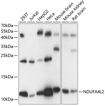 Anti-NDUFA4L2 Antibody (CAB14288)