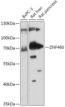 Anti-ZNF460 Antibody (CAB17621)