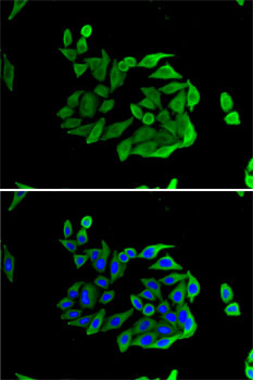 Anti-Heparanase 1 Antibody (CAB5726)