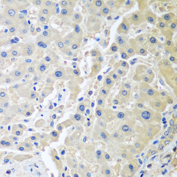 Anti-LRP6 Antibody (CAB13324)