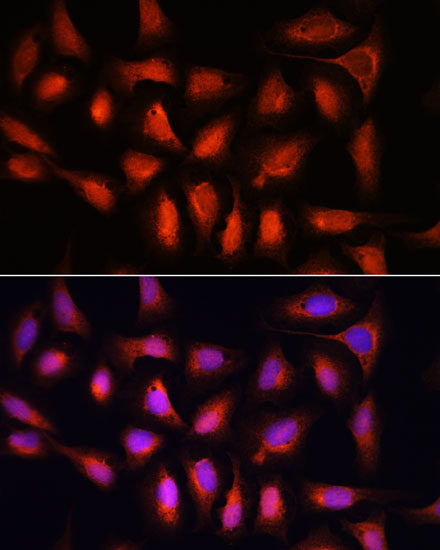 Anti-IRF1 Antibody (CAB7692)