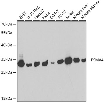 Anti-PSMA4 Antibody (CAB2511)
