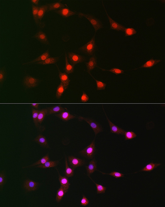 Anti-CDKN2D Antibody (CAB6556)